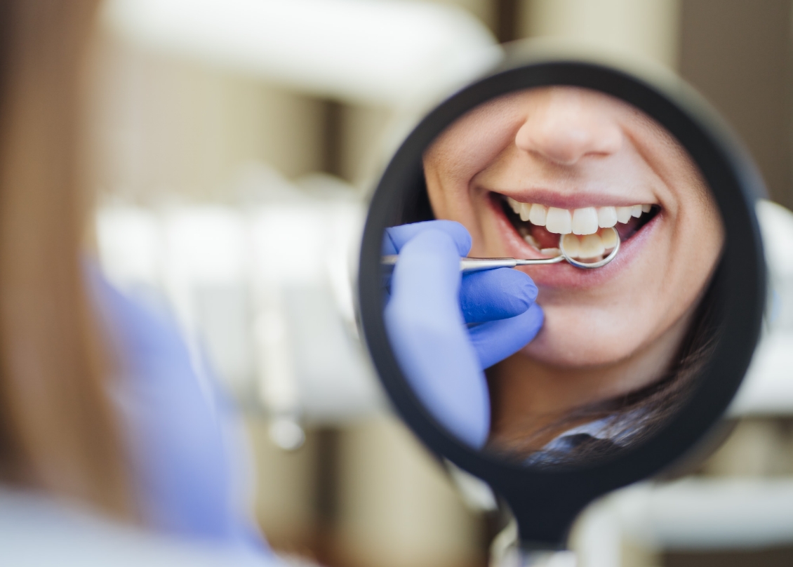 Füllungstherapie BonnSmile